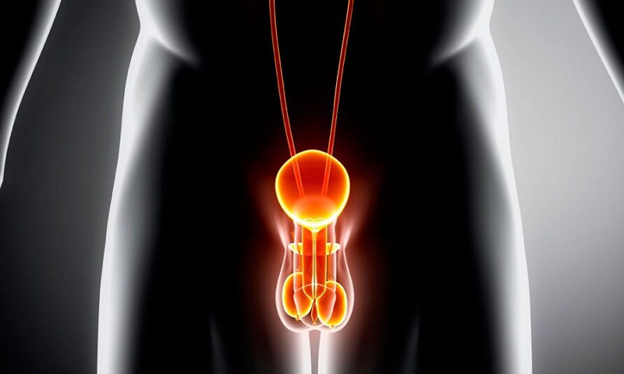 Entzündete Elternsystem für Prostatitis