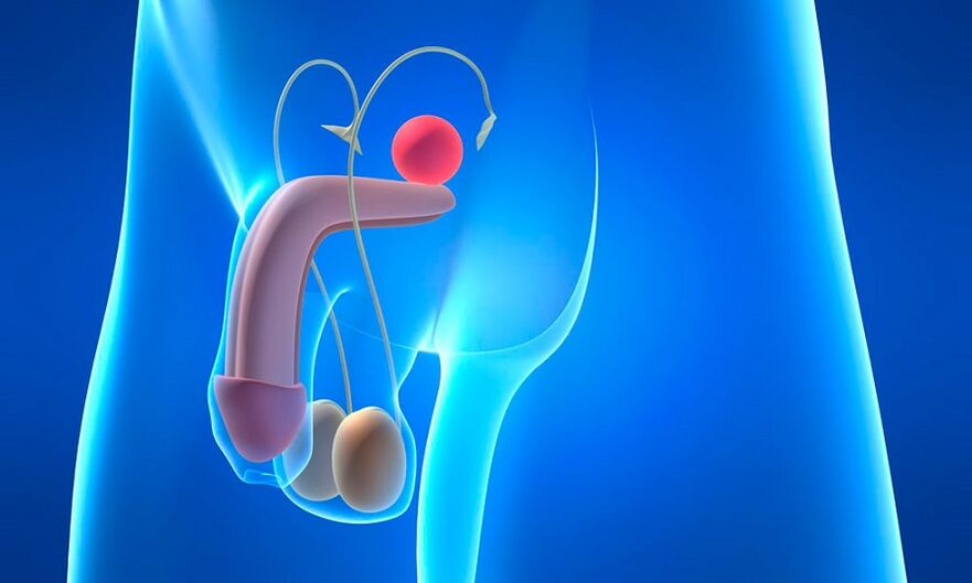 Prostataödem mit Prostatitis